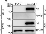 Fig.3.M showing Western Blotting from the publication: TANGO6 regulates cell proliferation via COPI vesicle-mediated RPB2 nuclear entry.