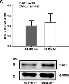 Sequestosome 1 Deficiency Delays, but Does Not Prevent Brain Damage Formation Following Acute Brain Injury in Adult Mice.