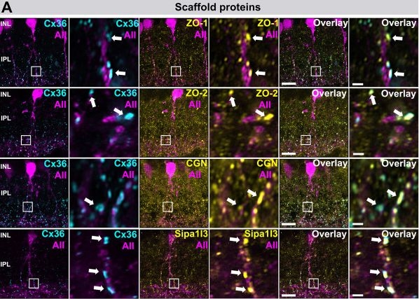 Fig.3.A showing Immunohistochemistry-immunofluorescence in a Homo sapiens (Human) sample from the publication: Uncovering the electrical synapse proteome in retinal neurons via in vivo proximity labeling.