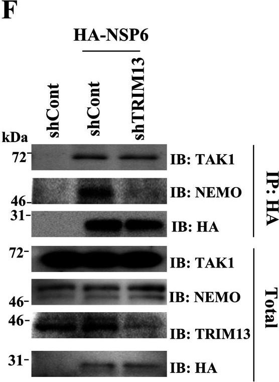 Fig.4.F showing Western Blotting in a Homo sapiens (Human) sample from the publication: Ubiquitination of SARS-CoV-2 NSP6 and ORF7a Facilitates NF-κB Activation.