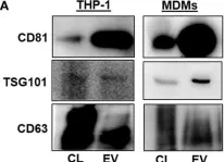 Fig.4.A showing Western Blotting from the publication: Macrophage-Derived Extracellular Vesicles Induce Long-Lasting Immunity Against Hepatitis C Virus Which Is Blunted by Polyunsaturated Fatty Acids.