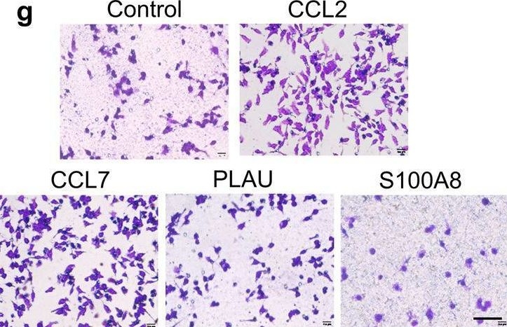 Fig.3.G showing Immunohistochemistry from the publication: Lactate dehydrogenase A regulates tumor-macrophage symbiosis to promote glioblastoma progression.