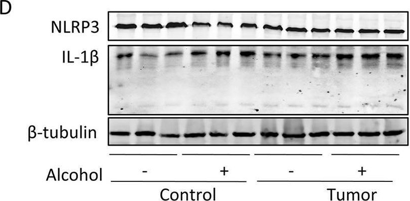 Fig.6.D showing Western Blotting in a Mus musculus (House mouse) sample from the publication: Alcohol intake aggravates adipose browning and muscle atrophy in cancer-associated cachexia.