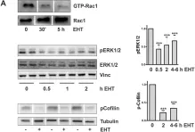 Fig.7.A showing Western Blotting from the publication: Actin-mediated gene expression depends on RhoA and Rac1 signaling in proximal tubular epithelial cells.