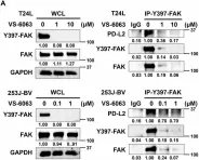 Fig.6.A showing Western Blotting from the publication: SPHK1 promotes bladder cancer metastasis via PD-L2/c-Src/FAK signaling cascade.