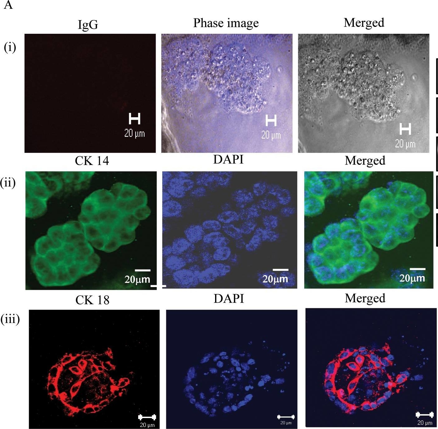 Reconstitution of mammary epithelial morphogenesis by murine embryonic stem cells undergoing hematopoietic stem cell differentiation.
