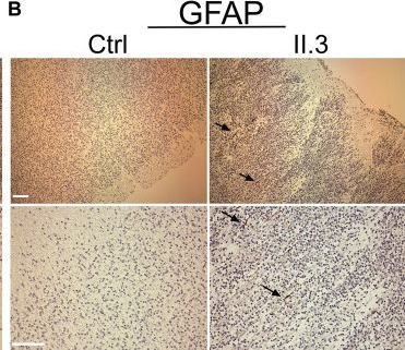 Fig.2.B showing Immunohistochemistry from the publication: Loss of Wwox Perturbs Neuronal Migration and Impairs Early Cortical Development.