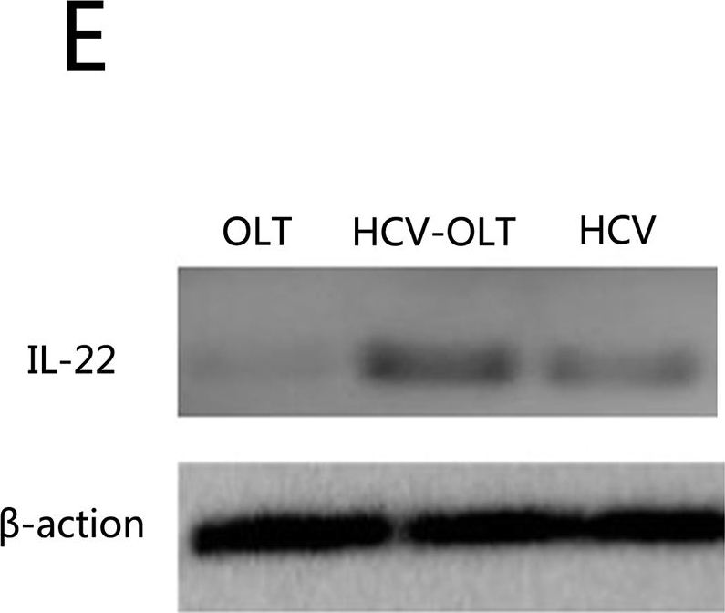 Fig.2.E showing Western Blotting in a Homo sapiens (Human) sample from the publication: Pathological Roles of Interleukin-22 in the Development of Recurrent Hepatitis C after Liver Transplantation.