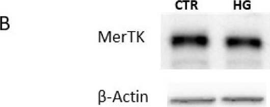 Fig.1.B showing Western Blotting in a Homo sapiens (Human) sample from the publication: High Glucose Impairs Expression and Activation of MerTK in ARPE-19 Cells.