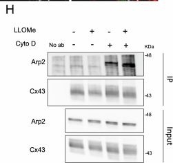 Fig.6.H showing Western Blotting from the publication: Connexin43 promotes exocytosis of damaged lysosomes through actin remodelling.