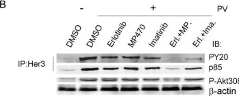 Fig.6.B showing Western Blotting from the publication: MP470, a novel receptor tyrosine kinase inhibitor, in combination with Erlotinib inhibits the HER family/PI3K/Akt pathway and tumor growth in prostate cancer.