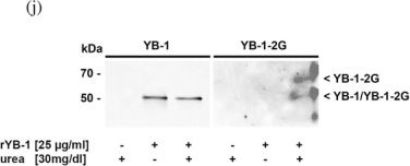 Fig.1.I showing Western Blotting from the publication: Guanidinylation of the cold shock protein YB-1: Molecular basis, structural changes and Notch-3 receptor binding.