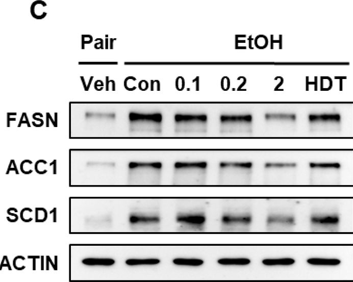 Fig.7.C showing Western Blotting from the publication: A novel yeast-derived aldehyde-reducing compound MF001 protects against alcohol-induced liver damage.
