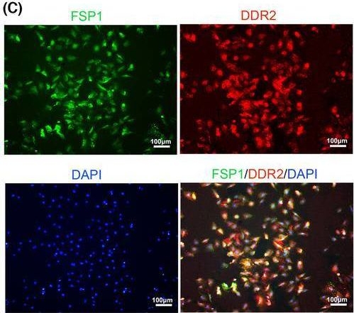 Fig.1.C showing Immunocytochemistry-immunofluorescence from the publication: Regulation of cardiac fibroblasts reprogramming into cardiomyocyte-like cells with a cocktail of small molecule compounds.