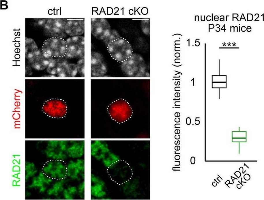 Fig.1.B showing Immunocytochemistry-immunofluorescence in a Mus musculus (House mouse) sample from the publication: Cohesin regulation of genome organization in mature granule neurons in the mouse cerebellum.
