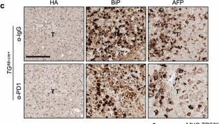 Fig.11.C showing Immunohistochemistry in a Mus musculus (House mouse) sample from the publication: Activated ATF6α is a hepatic tumour driver restricting immunosurveillance.