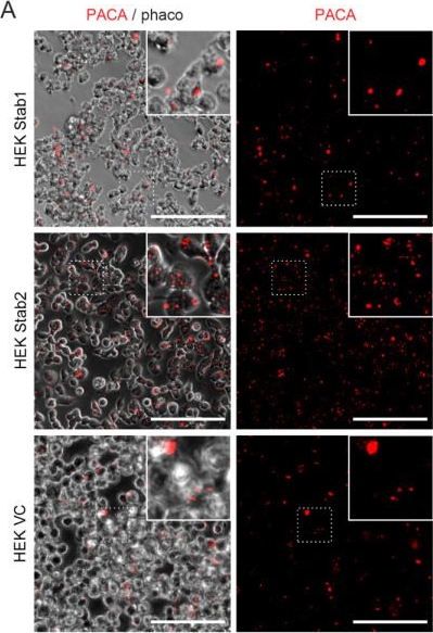 Fig.2.A showing Immunocytochemistry-immunofluorescence from the publication: PACA nanoparticles target and deliver sildenafil to rejuvenate aged mouse liver sinusoidal endothelial cells.
