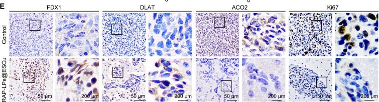 Fig.7.E showing Immunohistochemistry from the publication: Engineered RAP-anchored copper-escorting liposomes for FDX1-targeted cuproptosis in glioblastoma therapy‌.