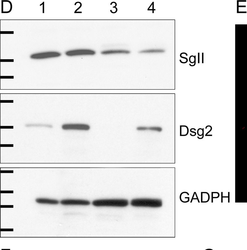 Desmoglein 2 depletion leads to increased migration and upregulation of the chemoattractant secretoneurin in melanoma cells.