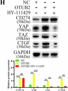 Fig.8.H showing Western Blotting from the publication: OTUB2 induces M2 tumor-associated macrophage polarization and increases CD274 expression in gastric cancer cells to aggravate the progression of gastric cancer.