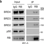 Fig.2.B showing Western Blotting from the publication: Retinoblastoma protein as an intrinsic BRD4 inhibitor modulates small molecule BET inhibitor sensitivity in cancer.