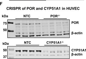 Fig.1.F showing Western Blotting from the publication: Endothelial cytochrome P450 -derived cholesterol limits angiogenesis.