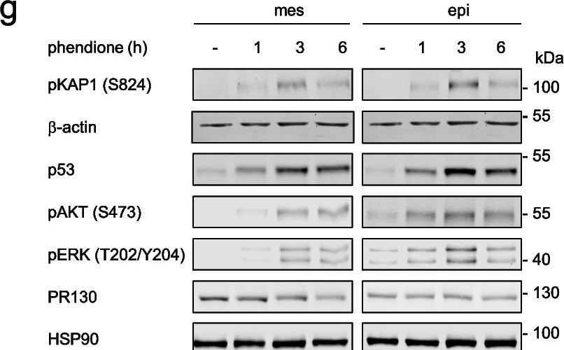 Fig.2.G showing Western Blotting in a Homo sapiens (Human) sample from the publication: The protein phosphatase-2A subunit PR130 is involved in the formation of cytotoxic protein aggregates in pancreatic ductal adenocarcinoma cells.