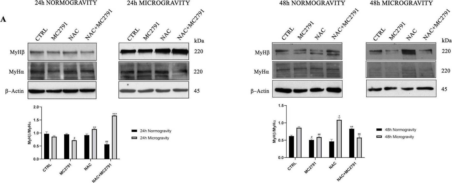 Fig.4.A showing Western Blotting from the publication: Role of SIRT3 in Microgravity Response: A New Player in Muscle Tissue Recovery.