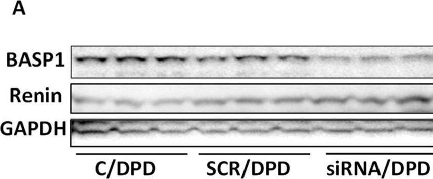Fig.8.A showing Western Blotting from the publication: APOL1 Modulates Renin-Angiotensin System.