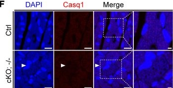 Fig.7.F showing Immunohistochemistry-immunofluorescence from the publication: Critical role of Znhit1 for postnatal heart function and vacuolar cardiomyopathy.