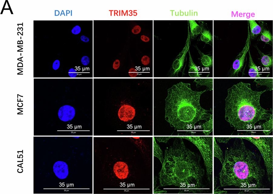 Fig.3.A showing Immunocytochemistry-immunofluorescence in a Homo sapiens (Human) sample from the publication: TRIM35, a novel DNA-binding protein, epigenetically modifies H3 to promote HSPA6 transcription and suppress breast cancer progression.