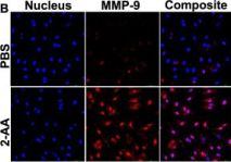 MMP-9 (D6O3H) Rabbit Monoclonal Antibody (Alexa Fluor® 488
