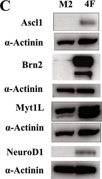 Fig.1.C showing Western Blotting from the publication: Direct transdifferentiation of tumorigenic melanoma cells induces tumor cell reversion.