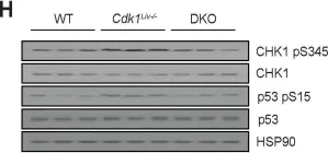 Fig.7.T showing Western Blotting from the publication: Loss of hepatocyte cell division leads to liver inflammation and fibrosis.
