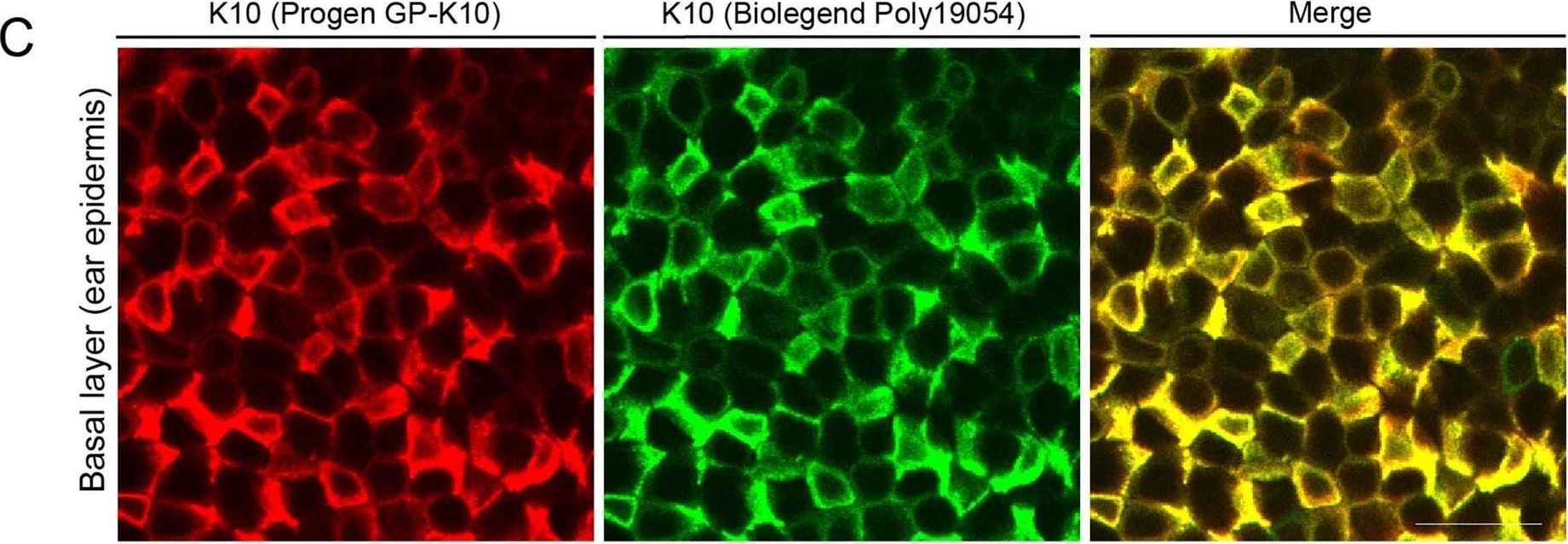 Gradual differentiation uncoupled from cell cycle exit generates heterogeneity in the epidermal stem cell layer.