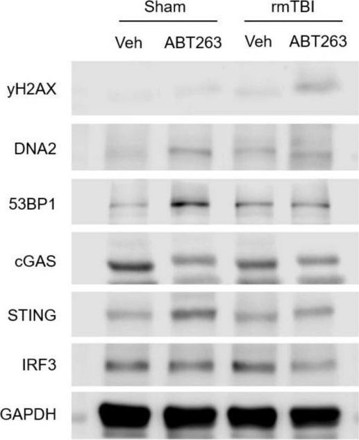 Fig.7.C showing Western Blotting in a Mus musculus (House mouse) sample from the publication: Neurons and glial cells acquire a senescent signature after repeated mild traumatic brain injury in a sex-dependent manner.