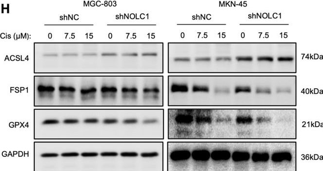 Fig.4.H showing Western Blotting in a Homo sapiens (Human) sample from the publication: NOLC1 suppresses immunochemotherapy by inhibiting p53-mediated ferroptosis in gastric cancer.