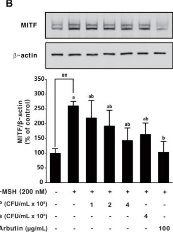 Fig.6.B showing Western Blotting from the publication: Anti-Photoaging and Anti-Melanogenic Effects of a Novel Lactiplantibacillus plantarum RKBP Isolated from Giant Centella asiatica.