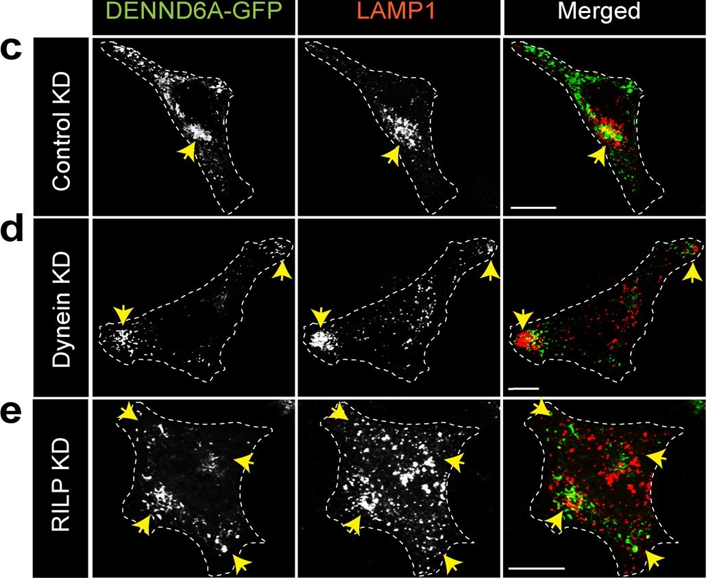 Fig.6.C showing Immunocytochemistry-immunofluorescence from the publication: DENND6A links Arl8b to a Rab34/RILP/dynein complex, regulating lysosomal positioning and autophagy.