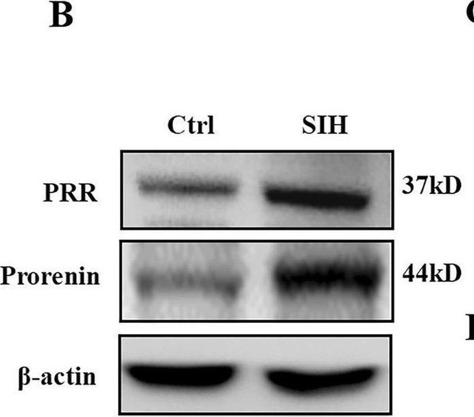 Fig.1.B showing Western Blotting in a Mus musculus (House mouse) sample from the publication: Microglia-Derived NLRP3 Activation Mediates the Pressor Effect of Prorenin in the Rostral Ventrolateral Medulla of Stress-Induced Hypertensive Rats.
