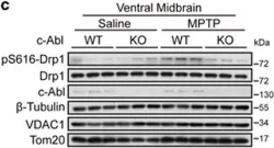 Fig.1.C showing Western Blotting from the publication: c-Abl-mediated Drp1 phosphorylation promotes oxidative stress-induced mitochondrial fragmentation and neuronal cell death.