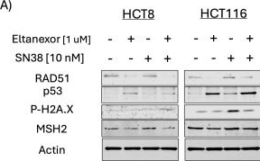 Fig.5.A showing Western Blotting in a Homo sapiens (Human) sample from the publication: Efficacy of an XPO1 inhibitor in combination with irinotecan in a preclinical colorectal cancer model.
