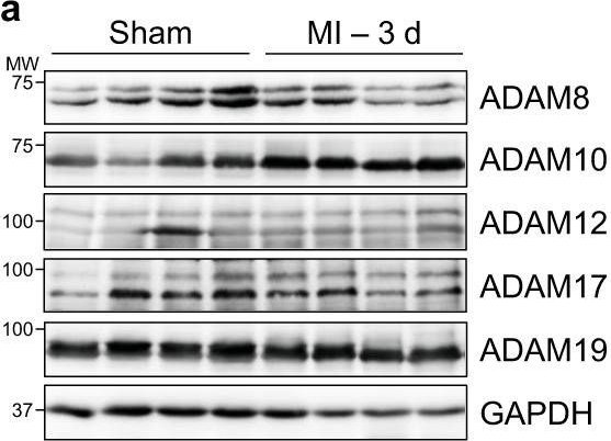 Fig.1.A showing Western Blotting from the publication: Targeting cardiomyocyte ADAM10 ectodomain shedding promotes survival early after myocardial infarction.