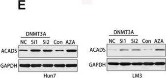Fig.6.E showing Western Blotting in a Homo sapiens (Human) sample from the publication: ACADS acts as a potential methylation biomarker associated with the proliferation and metastasis of hepatocellular carcinomas.