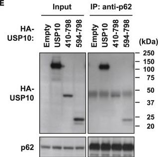 USP10 Is a Driver of Ubiquitinated Protein Aggregation and Aggresome Formation to Inhibit Apoptosis.