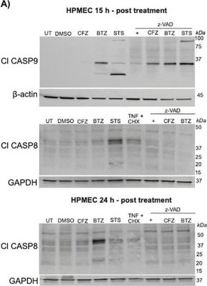 Fig.2.A showing Western Blotting in a Homo sapiens (Human) sample from the publication: Proteasomal inhibition compromises microvascular integrity via distinct effects on non-immune endothelial cells and immune cells.