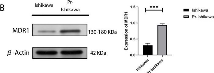 Fig.1.B showing Western Blotting in a Homo sapiens (Human) sample from the publication: IKBKE modulates autophagy and progestin resistance in endometrial cancer.