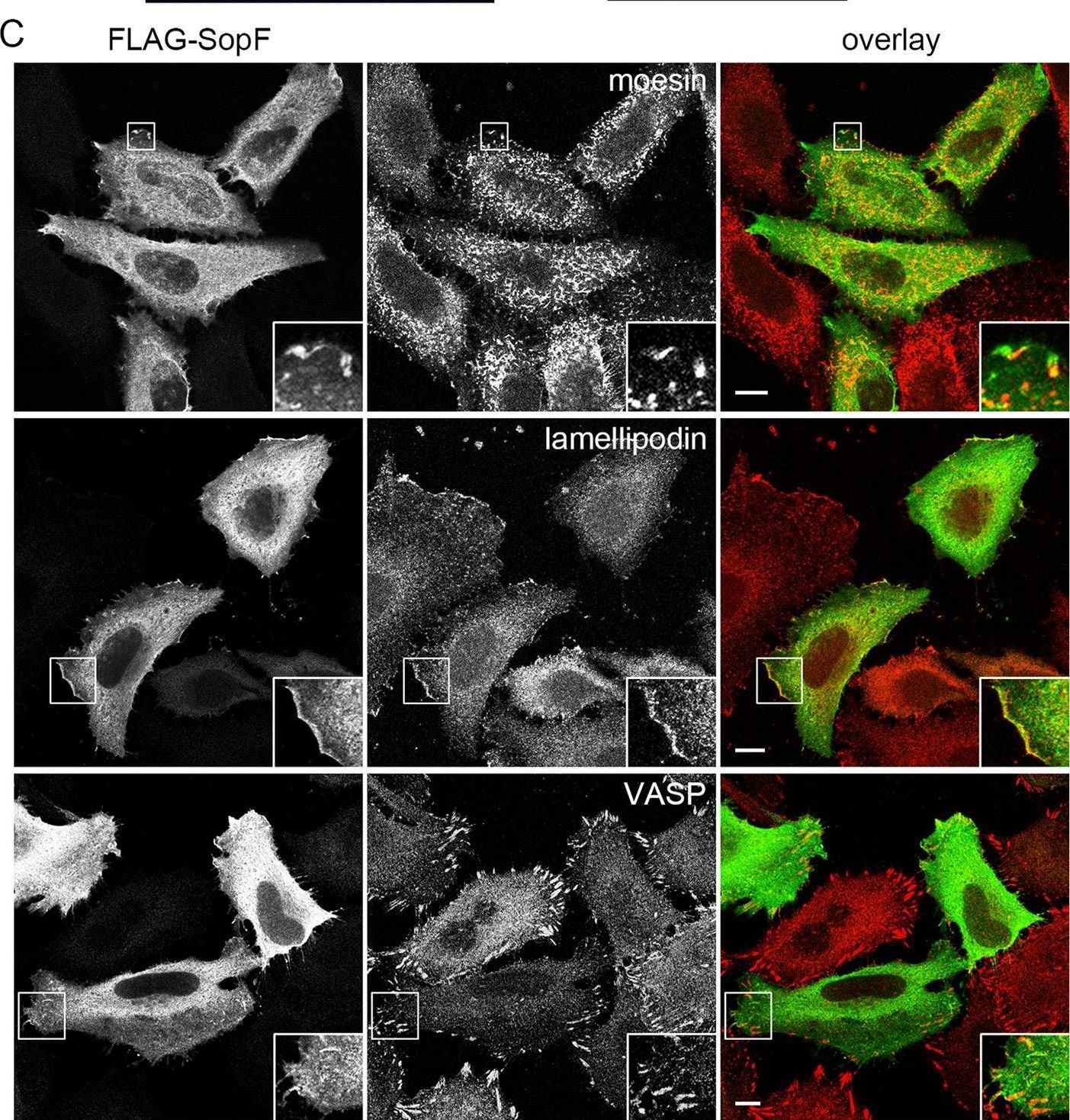 Fig.2.C showing Immunocytochemistry-immunofluorescence in a Homo sapiens (Human) sample from the publication: SopF, a phosphoinositide binding effector, promotes the stability of the nascent Salmonella-containing vacuole.