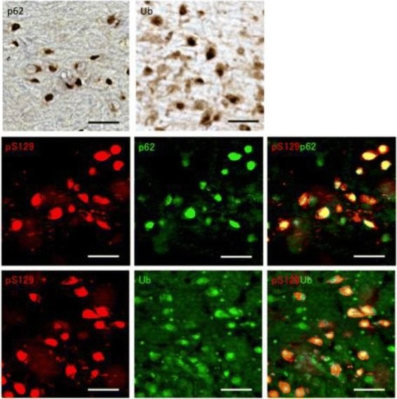 Propagation of pathological α-synuclein in marmoset brain.