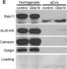 Fig.7.E showing Western Blotting in a Drosophila melanogaster (Fruit fly) sample from the publication: Glucocerebrosidase deficiency promotes protein aggregation through dysregulation of extracellular vesicles.